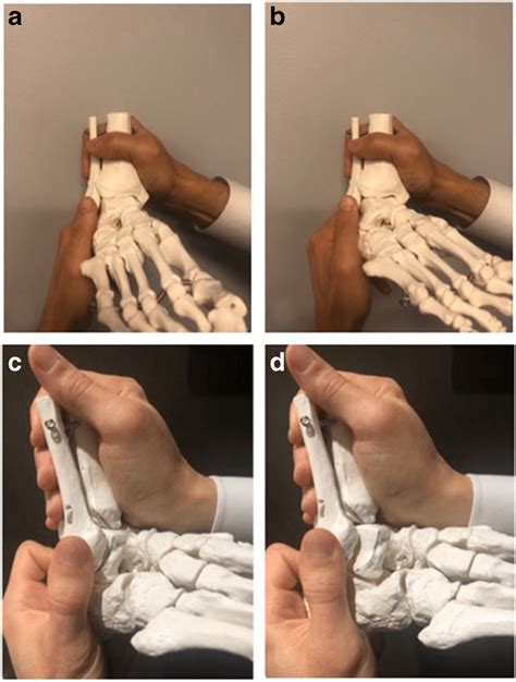 anterior talofibular ligament stress test